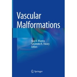 Vascular Malformations