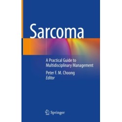 Sarcoma: A Practical Guide to Multidisciplinary Management