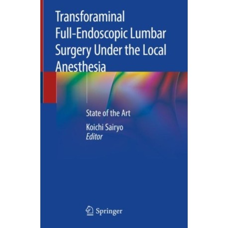 Transforaminal Full-Endoscopic Lumbar Surgery Under the Local Anesthesia: State of the Art