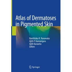 Atlas of Dermatoses in Pigmented Skin
