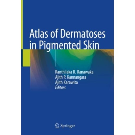 Atlas of Dermatoses in Pigmented Skin