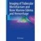 Imaging of Trabecular Microfracture and Bone Marrow Edema and Hemorrhage