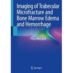 Imaging of Trabecular Microfracture and Bone Marrow Edema and Hemorrhage