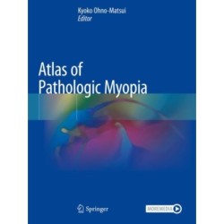 Atlas of Pathologic Myopia