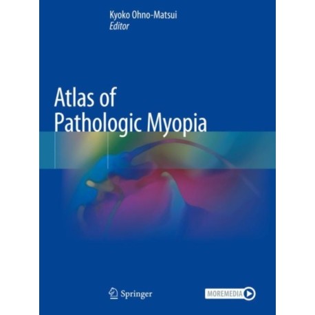 Atlas of Pathologic Myopia