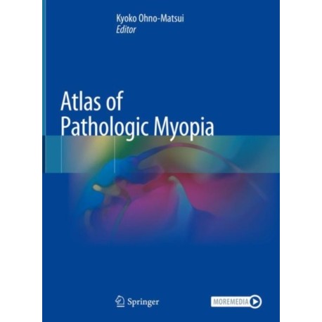 Atlas of Pathologic Myopia