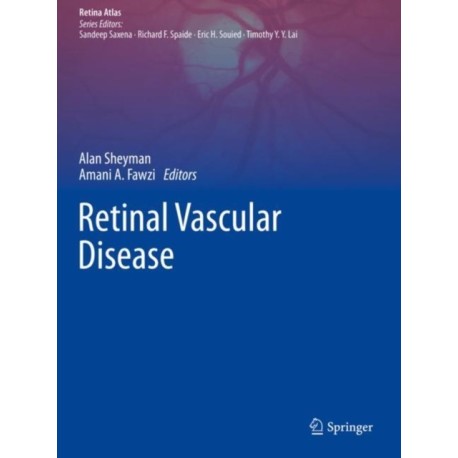 Retinal Vascular Disease