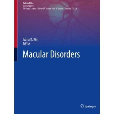 Macular Disorders