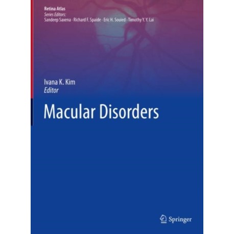 Macular Disorders