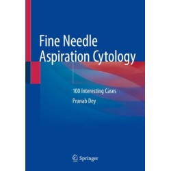 Fine Needle Aspiration Cytology: 100 Interesting Cases