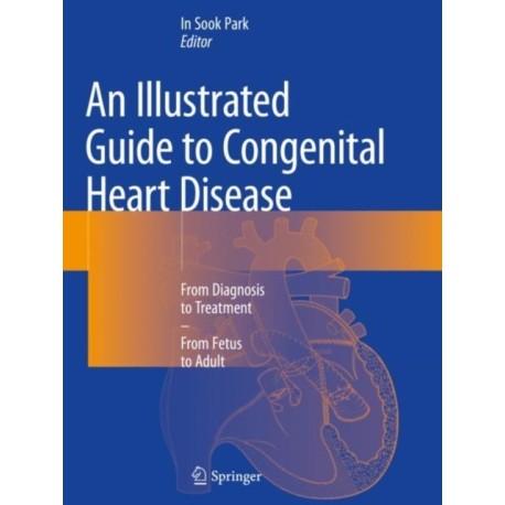 An Illustrated Guide to Congenital Heart Disease: From Diagnosis to Treatment – From Fetus to Adult
