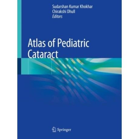 Atlas of Pediatric Cataract