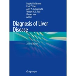 Diagnosis of Liver Disease