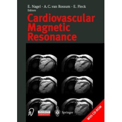 Cardiovascular Magnetic Resonance