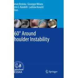 360° Around Shoulder Instability