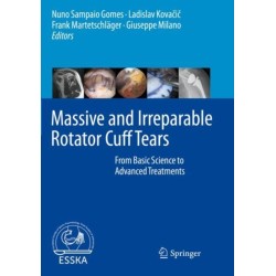 Massive and Irreparable Rotator Cuff Tears: From Basic Science to Advanced Treatments