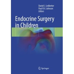 Endocrine Surgery in Children