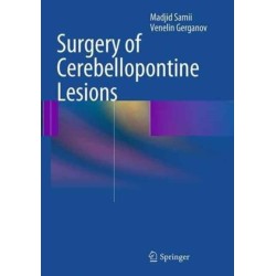 Surgery of Cerebellopontine Lesions