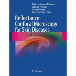 Reflectance Confocal Microscopy for Skin Diseases