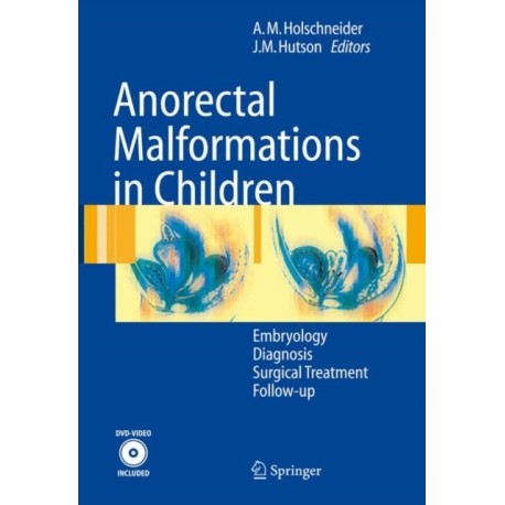 Anorectal Malformations in Children: Embryology, Diagnosis, Surgical Treatment, Follow-up