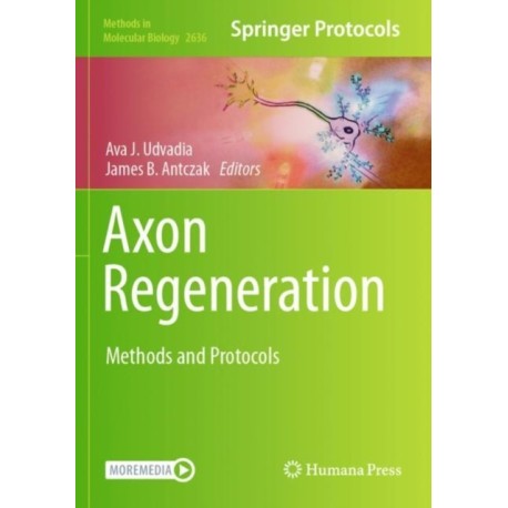 Axon Regeneration: Methods and Protocols