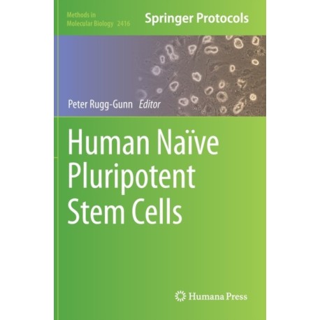 Human Naive Pluripotent Stem Cells