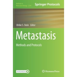 Metastasis: Methods and Protocols