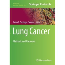 Lung Cancer: Methods and Protocols