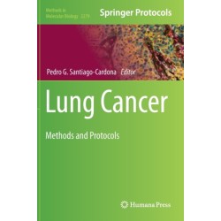 Lung Cancer: Methods and Protocols