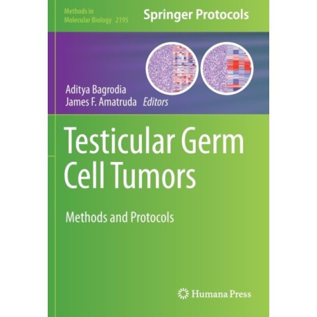 Testicular Germ Cell Tumors: Methods and Protocols