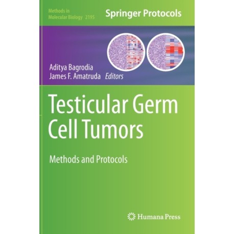 Testicular Germ Cell Tumors: Methods and Protocols