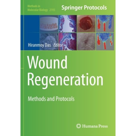 Wound Regeneration: Methods and Protocols