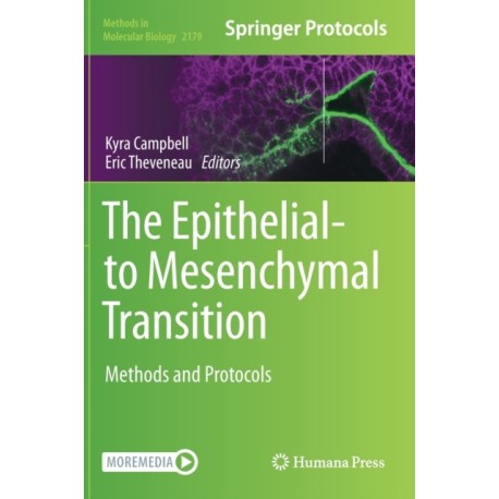 The Epithelial-to Mesenchymal Transition: Methods and Protocols