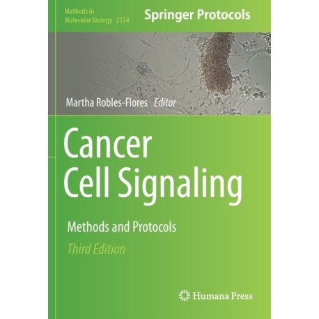 Cancer Cell Signaling: Methods and Protocols