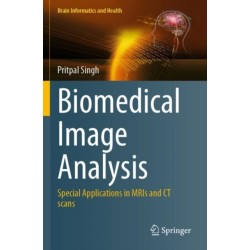 Biomedical Image Analysis: Special Applications in MRIs and CT scans