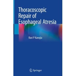 Thoracoscopic Repair of Esophageal Atresia