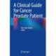 A Clinical Guide for Cancer Prostate Patient