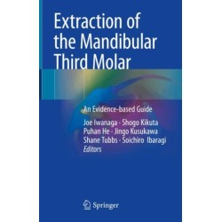 Extraction of the Mandibular Third Molar: An Evidence-based Guide