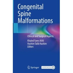 Congenital Spine Malformations: Clinical and Surgical Aspects