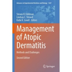 Management of Atopic Dermatitis: Methods and Challenges