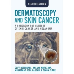 Dermatoscopy and Skin Cancer, second edition: A handbook for hunters of skin cancer and melanoma