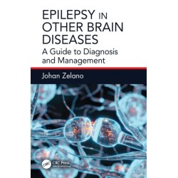 Epilepsy in Other Brain Diseases: A Guide to Diagnosis and Management