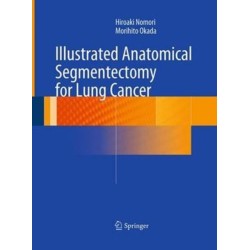 Illustrated Anatomical Segmentectomy for Lung Cancer