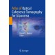 Atlas of Optical Coherence Tomography for Glaucoma