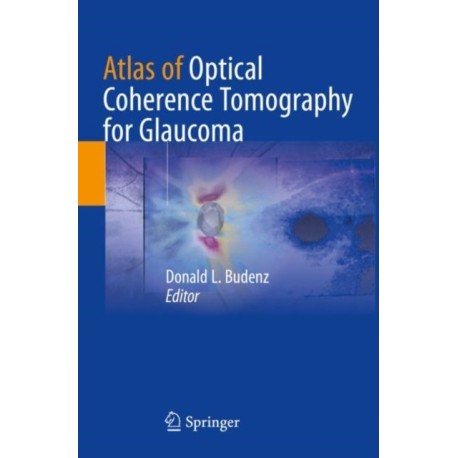 Atlas of Optical Coherence Tomography for Glaucoma