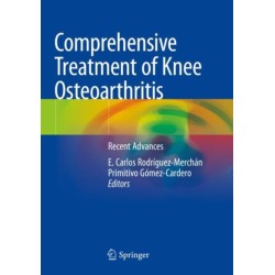 Comprehensive Treatment of Knee Osteoarthritis: Recent Advances