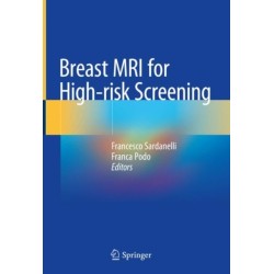 Breast MRI for High-risk Screening