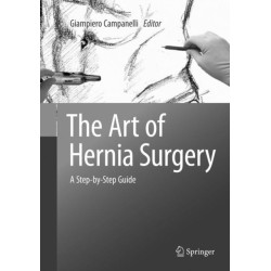 The Art of Hernia Surgery: A Step-by-Step Guide