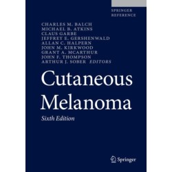 Cutaneous Melanoma
