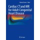 Cardiac CT and MR for Adult Congenital Heart Disease